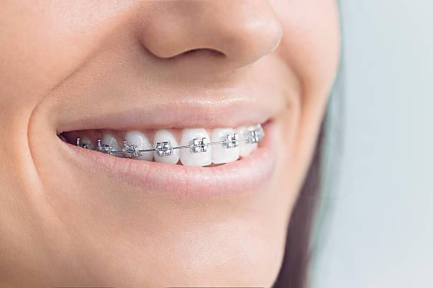 Best Wisdom Tooth Removal  in Cabana Colony, FL